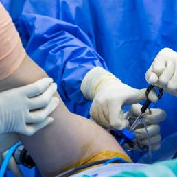 Cirugía Artroscópica de Hombro