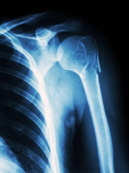 Resuelve tus dolencias del hombro y retoma tus actividades diarias con libertad y sin dolor.