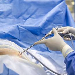 Cirugía de Columna Vertebral