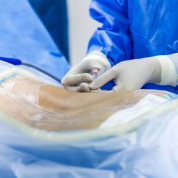 Cirugía de Columna Vertebral